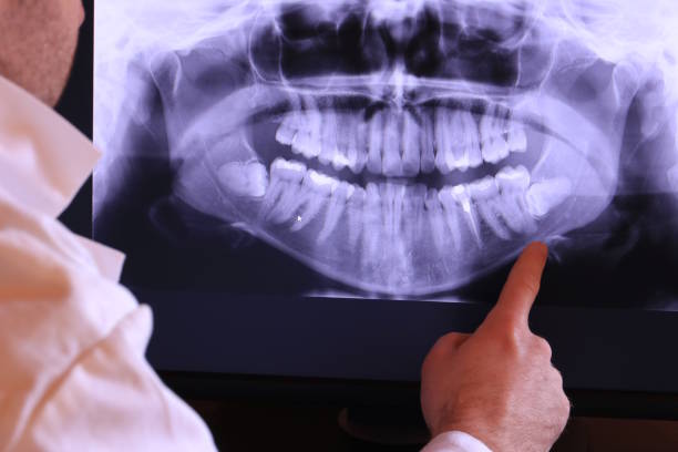 Best Emergency Broken Tooth Repair in Noble, OK