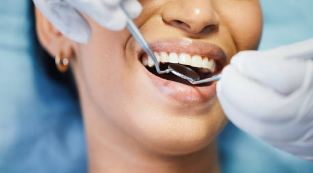 Best Emergency Tooth Extraction in Noble, OK