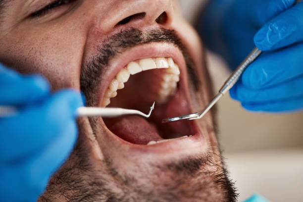 Best Emergency Tooth Extraction in Noble, OK